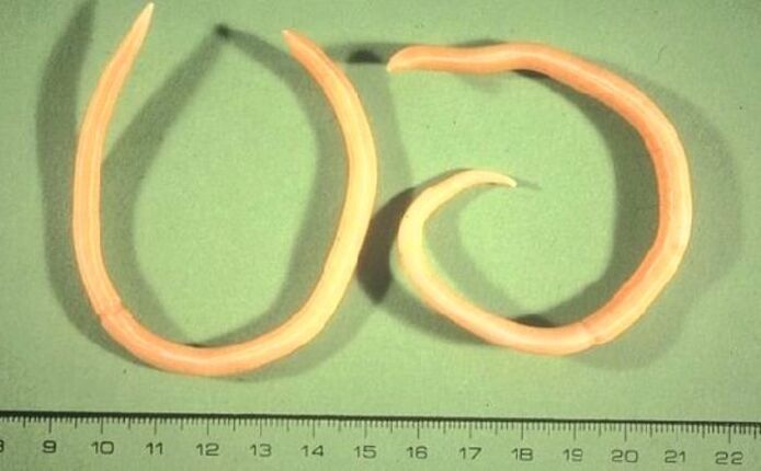 human body pinworm
