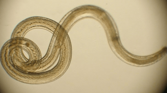 parasitic worm of the human body