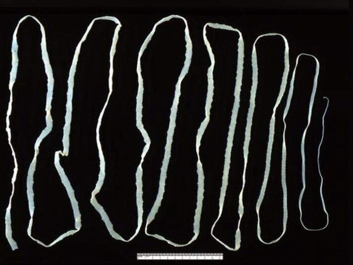 bovine tapeworm enters a person through the beef