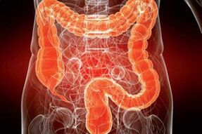 human intestine infested with parasites