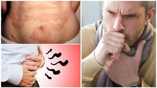 Allergies, coughing and bloating are signs of worm damage to the body