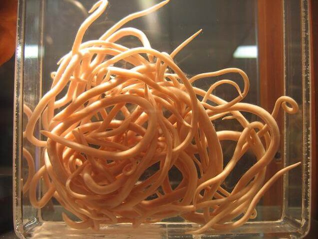 Roundworms are worms belonging to the class of nematodes. 