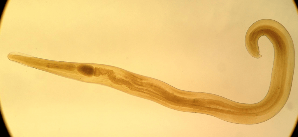 Pinworm is a common parasite in children. 