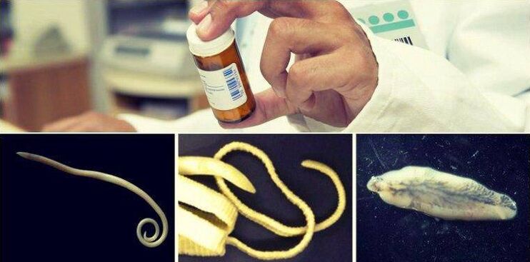 Types of worms and medicinal method to get rid of them
